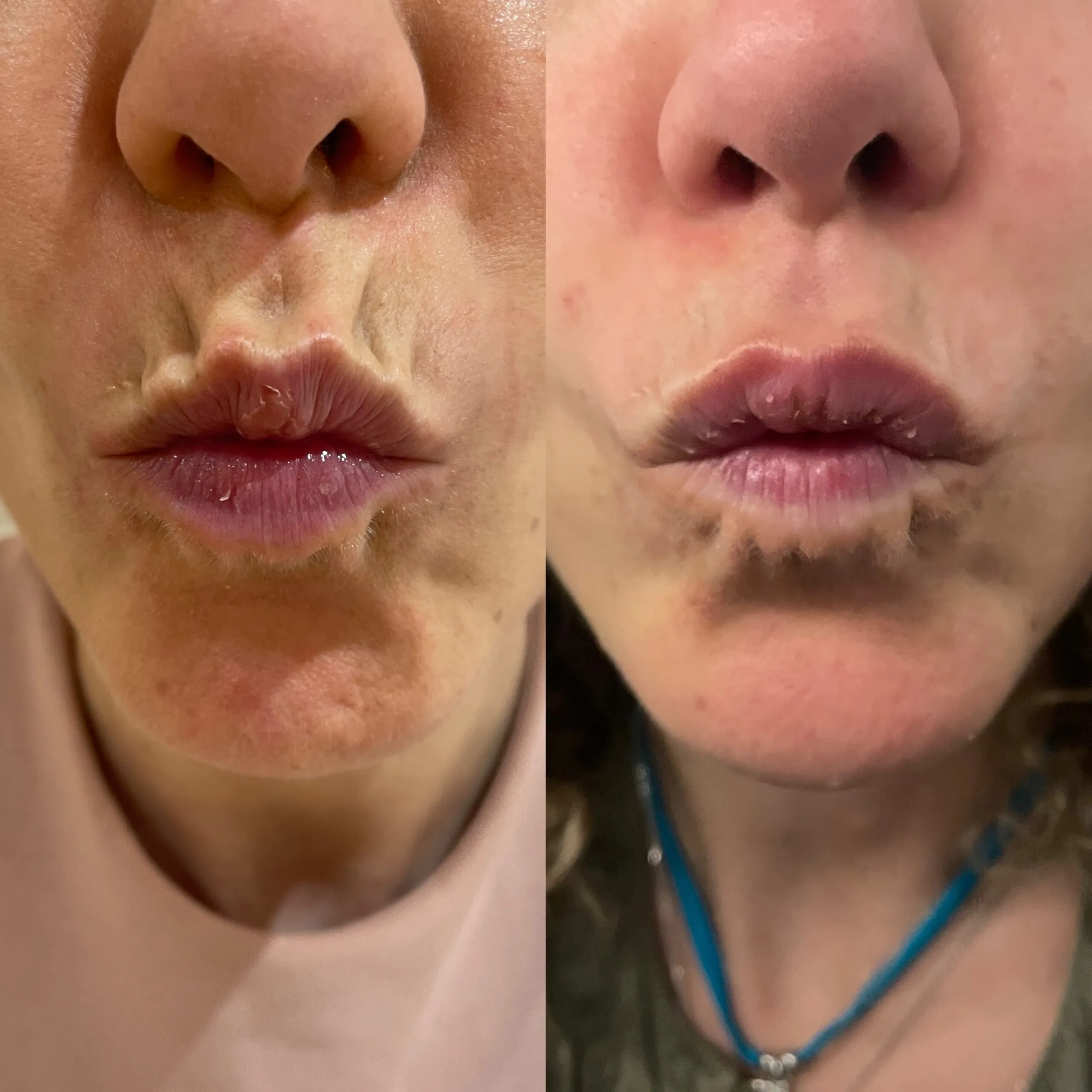 Antes y después — Código de barras en Marbella